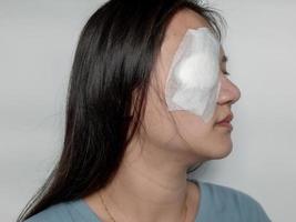 Systemic eye woman being treated from Hordeolum disease By piercing and scraping the pus out and covering it with a gauze cloth. photo