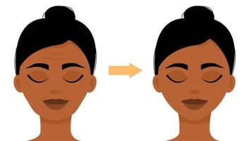 Wrinkles, age signs on a woman's face. The result of the procedure. Cosmetology, massage. Before and after the procedure. Vector illustration.
