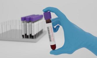 tubos de ensayo con etiqueta de prueba de sangre y coronavirus aislados sobre fondo blanco. concepto para probar el virus de la corona. representación 3d foto