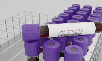 Test tubes with blood and coronavirus test label  isolated on white background. Concept for testing corona virus. 3D Rendering. photo