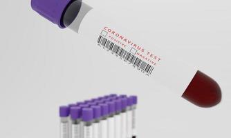 Test tubes with blood and blank label  isolated on white background. Concept for testing corona virus. 3D Rendering. photo