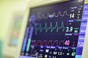 monitor ekg en máquina de bomba de globo intraaórtico en icu sobre fondo borroso, ondas cerebrales en electroencefalograma, onda de frecuencia cardíaca foto