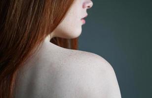 mujer joven que muestra el hombro desnudo con pecas en la piel foto