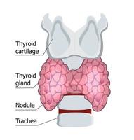 glándula tiroides humana aislada en el fondo blanco. vector de concepto de hipotiroidismo. ilustración de diagnóstico de endocrinología. cartílago tiroides, se muestra la tráquea. plantilla de medicina para sitio web