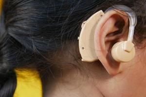 concepto de audífono, un niño con problemas de audición.