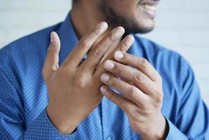 hombre que sufre dolor en la mano de cerca foto