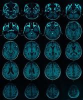 image of CT MRI brain photo