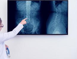 Doctora señalando con el dedo índice la imagen de rayos X de la columna vertebral foto