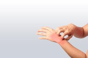 woman scraching rash at wrist joint