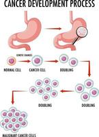 Diagram showing cancer development process vector