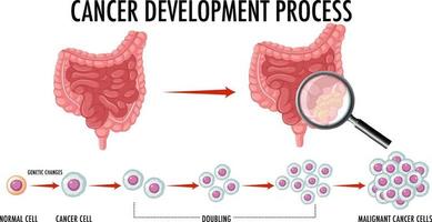 Diagram showing cancer development process vector