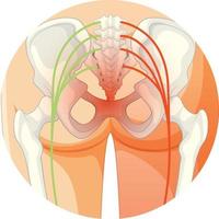 espalda baja que sufre de espondilitis anquilosante vector