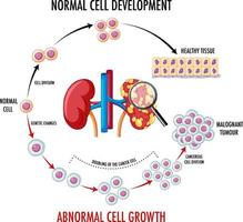 Diagram showing normal and cancer cell vector