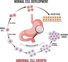 diagrama que muestra células normales y cancerosas vector