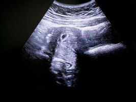 ultrasound of embryo at 5th weeks in pregnant woman photo