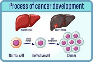 Process of cancer development vector