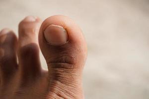 finger of feet close up image