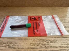 Blood specimen in test tube and plastic bag photo