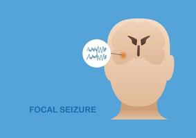 Focal seizure from temporal lobe vector
