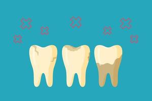 Vector illustration of sore tooth. Tartar on the teeth. Not hygienic.