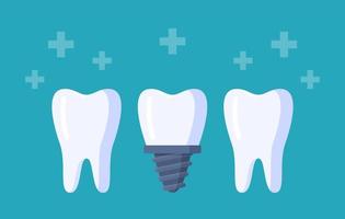 Vector illustration of tooth row. Three teeth isolated on a blue background.