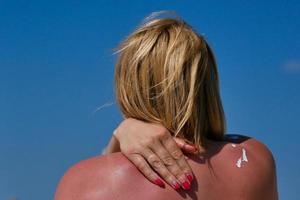 mujer frota protector solar en su hombro. contra el fondo del mar. foto