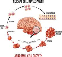 Diagram showing human brain and cancer vector