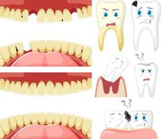 Set of all types of teeth on white background vector