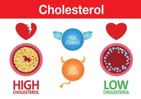Cholesterol in artery, health risk ,exercise, vector design