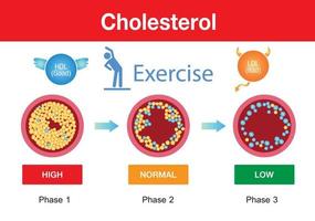 colesterol en arteria, riesgo para la salud, ejercicio, diseño de vectores