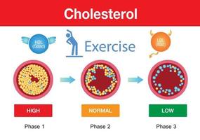 Cholesterol in artery, health risk ,exercise, vector design