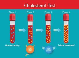 colesterol en arteria, riesgo para la salud, niveles de colesterol, diseño vectorial vector