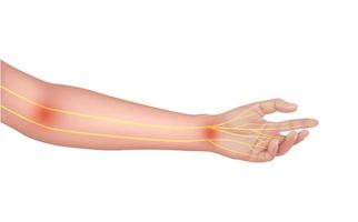 nervio del brazo sobre anatomía humana amarillo. sobre un fondo blanco. conceptos médicos y científicos. 3d vectoriales eps10. vector