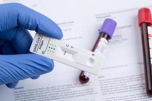 Negative test result by using rapid test device for COVID-19. photo