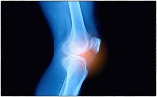 película de rayos x de las articulaciones de la rodilla del ser humano foto