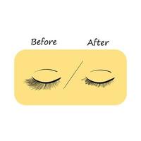 Eyelash extension. Improper eyelash extensions. Consequences of eyelash extensions. Harmful preparations for eyelashes. vector