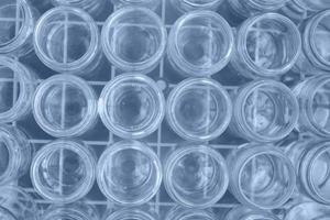 Sorting and collection of glass containers for recycling and reuse. photo