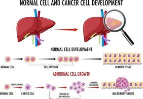 Diagram showing normal and cancer cell vector