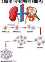 Diagram showing cancer development process vector