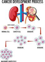 diagrama que muestra el proceso de desarrollo del cáncer vector