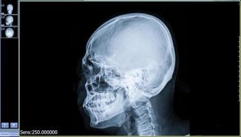 Film x-ray skull and cervical spine lateral view for medical concept. photo