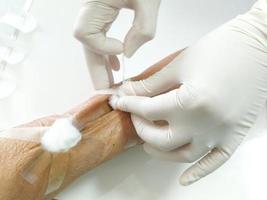 Close up of nurse's hand is covering the wound on arm of kidney failure on white table background in medical and health care concept photo