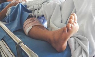 foot splint with iron on leg photo