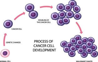 proceso de desarrollo de células cancerosas vector