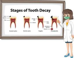 Infographic of human in the stages of tooth decay vector