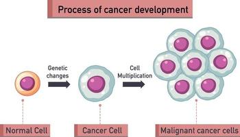 Infografía del proceso de desarrollo del cáncer. vector