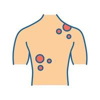 Skin cancer color icon. Dermatological diseases. Rash, spots on back. Melanoma. Isolated vector illustration