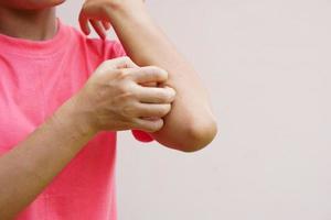 mujer rascándose el brazo por picazón en un fondo gris claro. la causa de la picazón en la piel incluye picaduras de insectos concepto de cuidado de la salud de la piel. foto