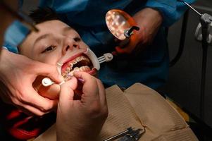 The teenager has braces glued to his upper teeth to straighten them, and the boy has a retractor on his lips. photo