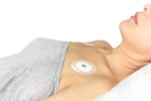 Heart electrocardiogram or monitoring using Holter for woman patient. photo